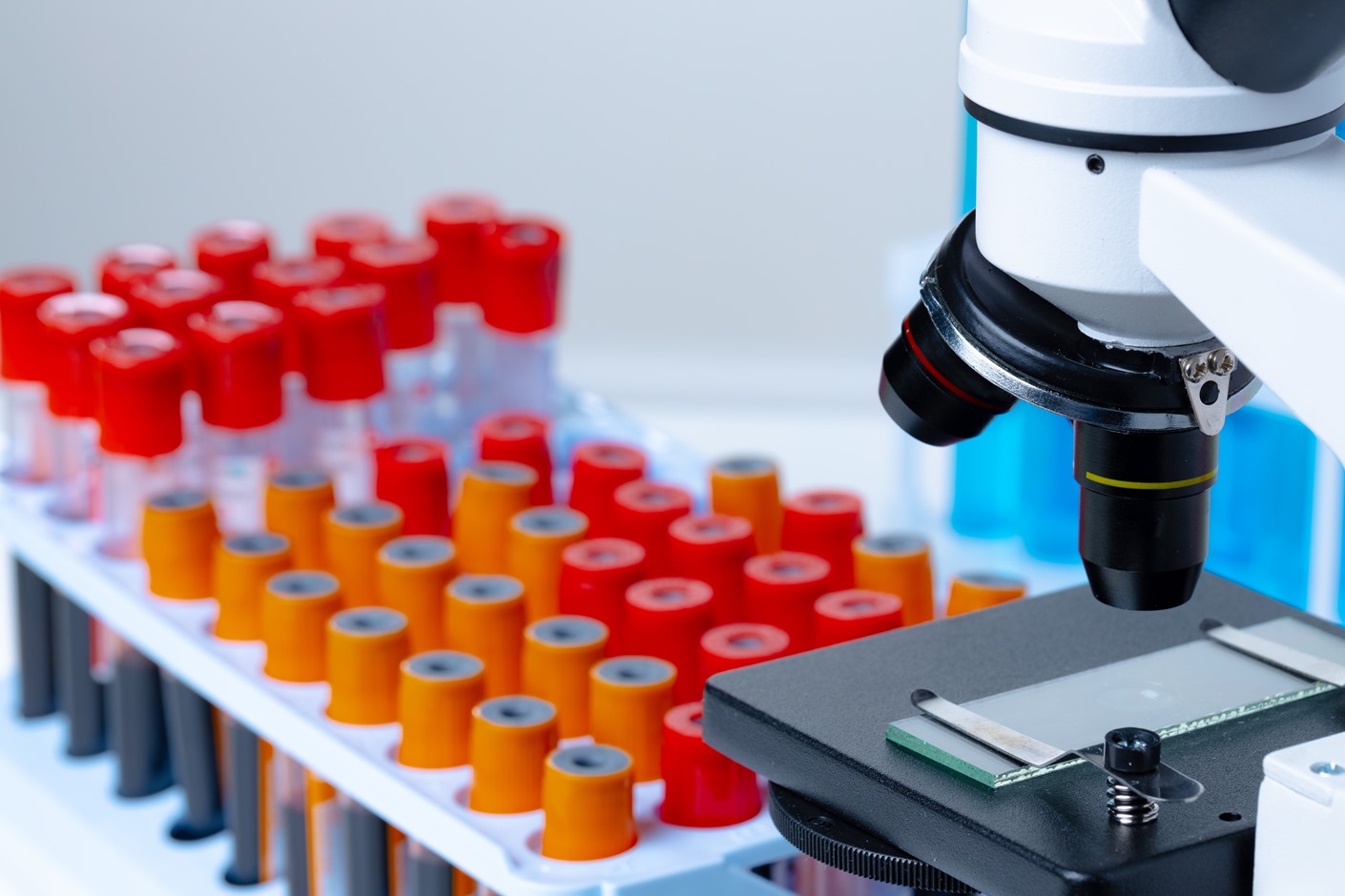 Laboratorio Analisi