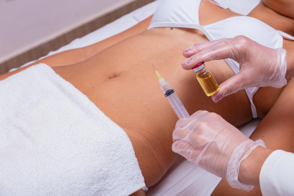 Mesoterapia